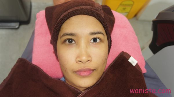 Untuk rawatan SilkPeel, muka akan dibersihkan dari sebarang mekap. Foto - Arkib Wanista