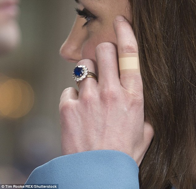 Lagi, jari telunjuk Kate diplaster bewarna seakan tona kulit. Foto - Daily Mail