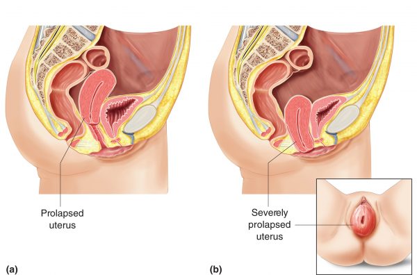 uterus-image
