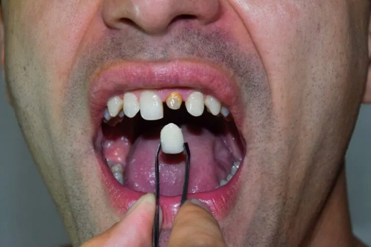 Foto - Dentistry